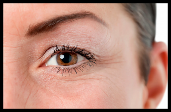 Шкіра навколо очей - Як позбавитись сухої шкіри навколо очей?