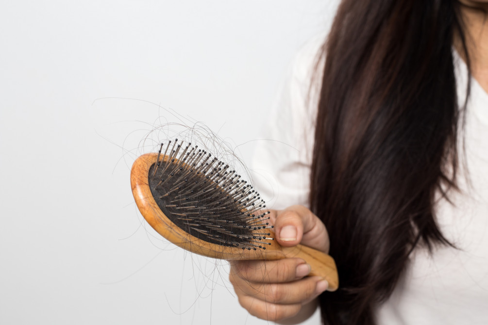 Випадіння волосся - Які є етапи випадіння волосся?