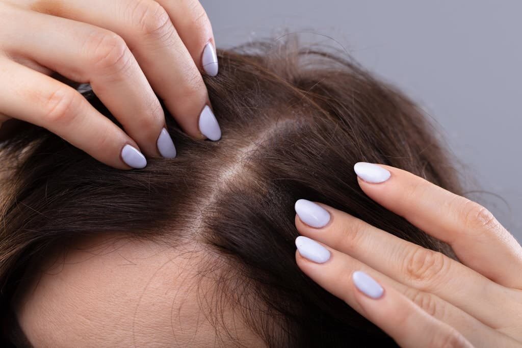 Випадання волосся - Як ліки впливають на випадання волосся?